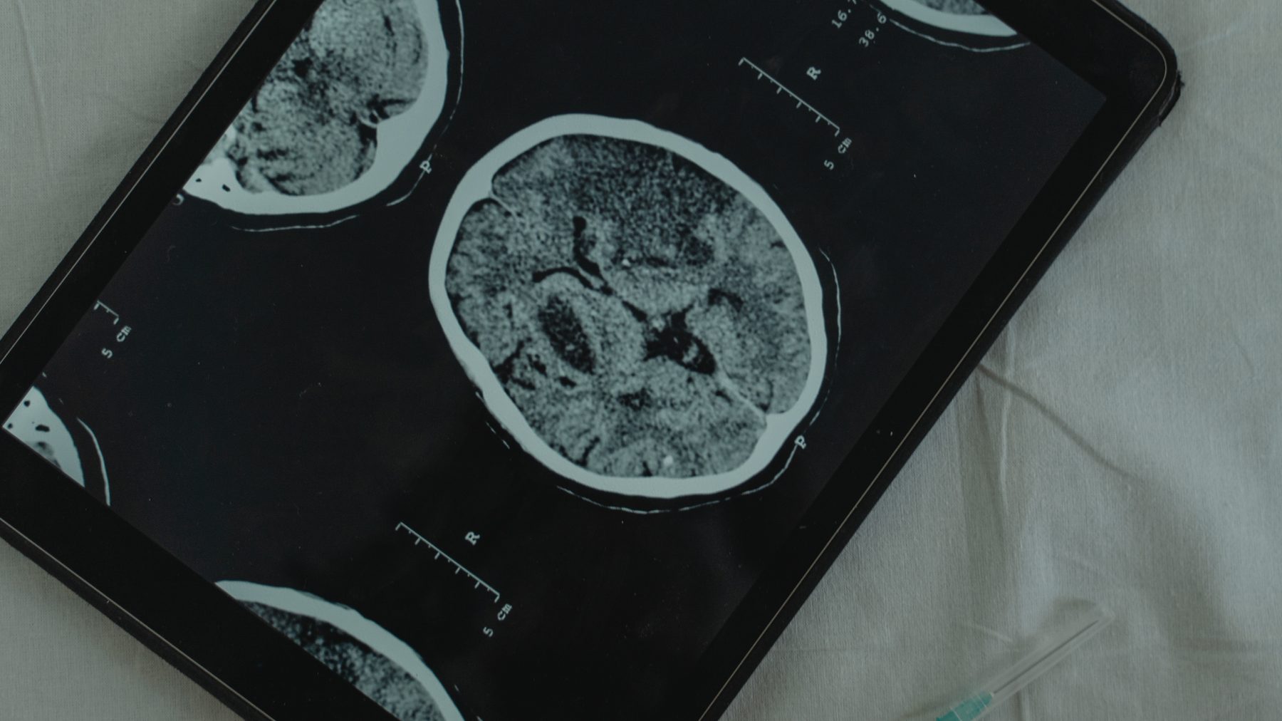Clinical brain imaging under review
